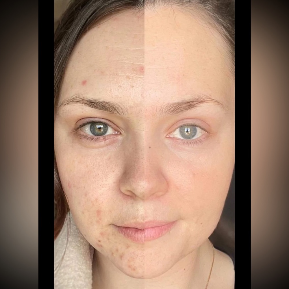 Younique daily you collagen 15 piece box